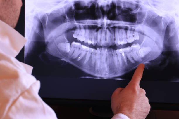 Best Emergency Gum Treatment in Bosque Farms, NM